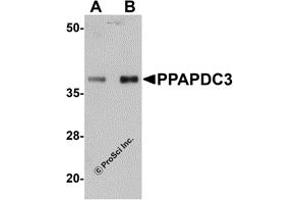 Western Blotting (WB) image for anti-Phosphatidic Acid Phosphatase Type 2 Domain Containing 3 (PPAPDC3) (Middle Region) antibody (ABIN1031044)