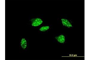 Image no. 1 for anti-Ubiquitin Protein Ligase E3 Component N-Recognin 2 (UBR2) (AA 1-100) antibody (ABIN565040)
