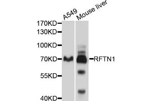 Image no. 1 for anti-Raftlin, Lipid Raft Linker 1 (RFTN1) antibody (ABIN4904993)