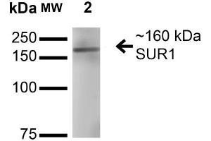 Image no. 2 for anti-ATP-Binding Cassette, Sub-Family C (CFTR/MRP), Member 8 (ABCC8) (AA 1548-1582) antibody (HRP) (ABIN2482997)