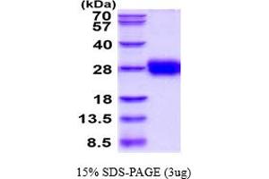 SDS-PAGE (SDS) image for Tissue Factor Pathway Inhibitor 2 (TFPI2) (AA 23-213) protein (His tag) (ABIN6387820)
