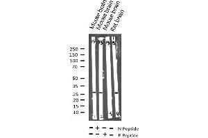 Western blot analysis of Phospho-p27 Kip1 (Thr187) expression in various lysates