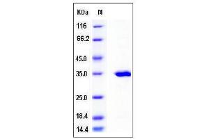 Image no. 1 for Sulfotransferase Family, Cytosolic, 2A, Dehydroepiandrosterone (DHEA)-Preferring, Member 1 (SULT2A1) (AA 2-285) protein (His tag) (ABIN2004274)
