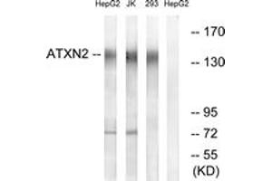 Image no. 1 for anti-Ataxin 2 (ATXN2) (AA 731-780) antibody (ABIN1534657)