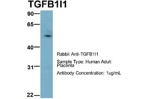 Image no. 8 for anti-Transforming Growth Factor beta 1 Induced Transcript 1 (TGFB1I1) (Middle Region) antibody (ABIN2777947)