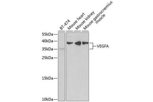 VEGFA anticorps  (AA 1-147)
