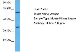 Image no. 1 for anti-Eukaryotic Translation Initiation Factor 5 (EIF5) (C-Term) antibody (ABIN2780433)