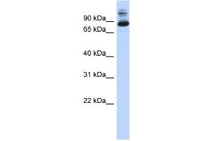 Image no. 1 for anti-SIX Homeobox 4 (SIX4) (N-Term) antibody (ABIN2781025)