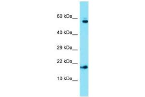 Image no. 1 for anti-Adaptor Related Protein Complex 1 sigma 1 (AP1S1) (C-Term) antibody (ABIN2790393)
