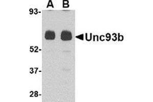 Image no. 1 for anti-Unc-93 Homolog B1 (UNC93B1) (N-Term) antibody (ABIN501104)