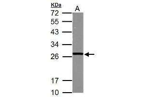 anti-Glutathione S-Transferase mu 5 (GSTM5) (Center) antibody