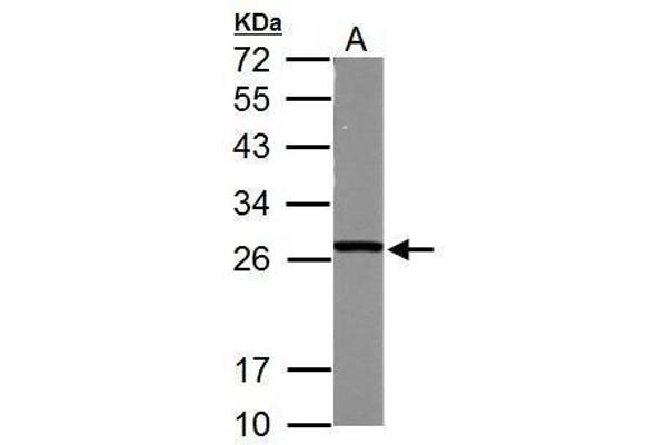 anti-Glutathione S-Transferase mu 5 (GSTM5) (Center) antibody