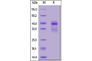 Image no. 2 for Interleukin 12 (IL12) (AA 23-328) (Active) protein (His tag,AVI tag,DYKDDDDK Tag,Biotin) (ABIN6973104)