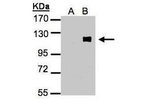 Image no. 2 for anti-Zinc Finger Protein 281 (ZNF281) (Center) antibody (ABIN2856161)
