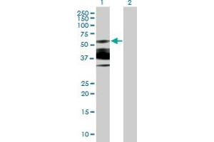 Image no. 1 for anti-Glyoxylate Reductase 1 Homolog (GLYR1) (AA 1-484) antibody (ABIN529740)