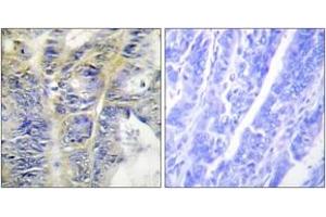 Image no. 1 for anti-Collagen, Type IV, alpha 5 (COL4A5) (AA 21-70) antibody (ABIN1534341)