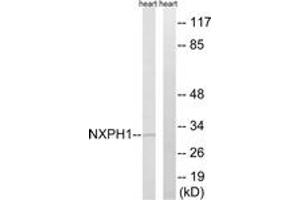 Image no. 1 for anti-Neurexophilin 1 (NXPH1) (AA 77-126) antibody (ABIN1535089)