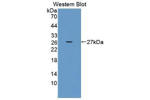 anti-3-Ketodihydrosphingosine Reductase (KDSR) (AA 64-271) antibody