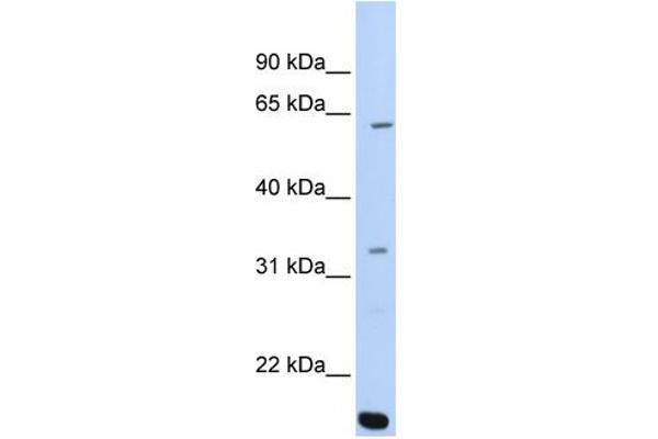 ARID5A antibody  (C-Term)