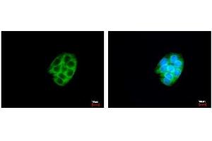 Image no. 1 for anti-Carboxylesterase 2 (CES2) (Center) antibody (ABIN2855810)