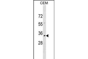 NKX2-6 Antibody (N-term) (ABIN1539020 and ABIN2849720) western blot analysis in CEM cell line lysates (35 μg/lane).