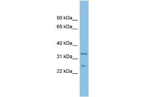 Image no. 2 for anti-Methionine Sulfoxide Reductase A (MSRA) (Middle Region) antibody (ABIN2786871)