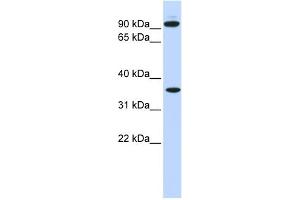 Image no. 1 for anti-Exostosin 2 (EXT2) (N-Term) antibody (ABIN2781795)