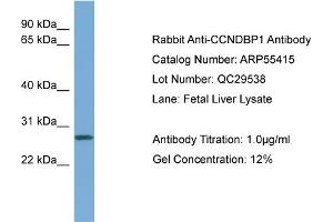 Image no. 2 for anti-Cyclin D-Type Binding-Protein 1 (CCNDBP1) (Middle Region) antibody (ABIN2786197)