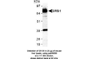 Image no. 6 for anti-Scavenger Receptor Class B, Member 1 (SCARB1) (AA 450-509), (C-Term) antibody (ABIN363399)