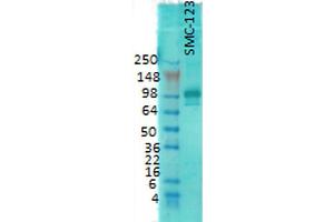 DLG4 anticorps  (HRP)