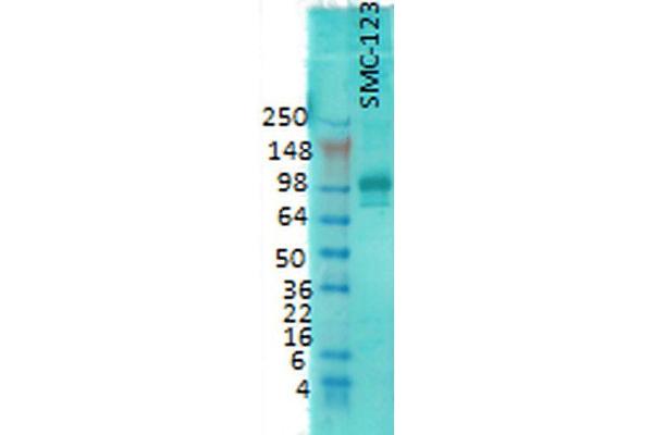 DLG4 anticorps  (HRP)