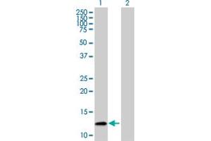 Image no. 1 for anti-S100 Calcium Binding Protein A10 (S100A10) (AA 1-97) antibody (ABIN519969)