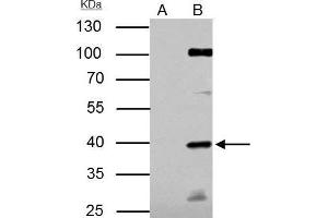 Image no. 3 for anti-E2F Transcription Factor 1 (E2F1) (Center) antibody (ABIN2854981)