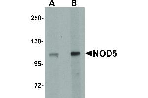 anti-NLR Family Member X1 (NLRX1) (N-Term) antibody