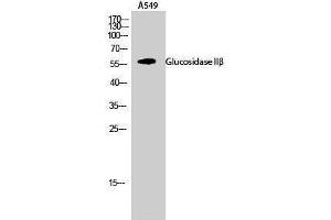 Image no. 1 for anti-Glucosidase, beta (Bile Acid) 2 (GBA2) (Internal Region) antibody (ABIN3184804)