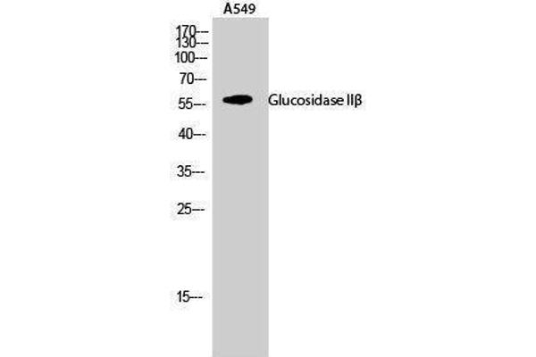 GBA2 Antikörper  (Internal Region)