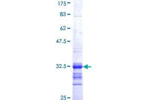 Image no. 1 for Somatostatin Receptor 2 (SSTR2) (AA 316-369) protein (GST tag) (ABIN1321441)