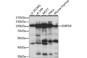 Image no. 1 for anti-Sphingomyelin Phosphodiesterase 4 (SMPD4) antibody (ABIN6568719)