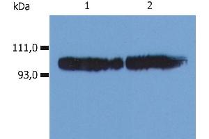 Image no. 2 for anti-Integrin beta 2 (ITGB2) antibody (PE) (ABIN192094)