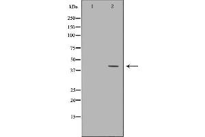 Image no. 3 for anti-Coxsackie Virus and Adenovirus Receptor (CXADR) (N-Term) antibody (ABIN6261118)