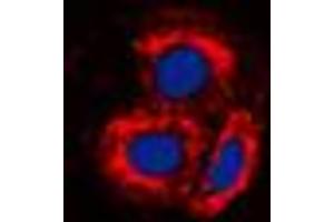 Image no. 1 for anti-Activin A Receptor Type II-Like 1 (ACVRL1) (Center) antibody (ABIN2705437)