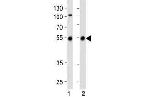 Image no. 4 for anti-Parkinson Protein 2, E3 Ubiquitin Protein Ligase (Parkin) (PARK2) (AA 111-140) antibody (ABIN3032153)