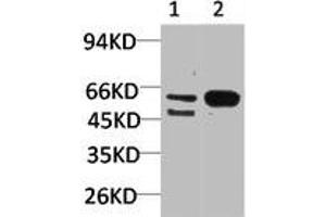 GABRA3 antibody