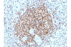 Image no. 4 for anti-B-Cell CLL/lymphoma 2 (BCL2) antibody (ABIN6940502)