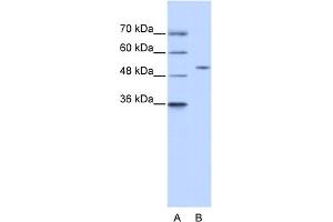 Image no. 1 for anti-Zinc Finger Protein 555 (ZNF555) (N-Term) antibody (ABIN2775110)