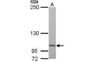 Image no. 3 for anti-Proteasome (Prosome, Macropain) 26S Subunit, Non-ATPase, 2 (PSMD2) (Center) antibody (ABIN2855347)
