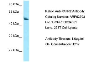 Image no. 1 for anti-Pantothenate Kinase 2 (PANK2) (C-Term) antibody (ABIN2789627)