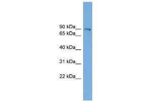 Image no. 1 for anti-UTP14, U3 Small Nucleolar Ribonucleoprotein, Homolog A (UTP14A) (N-Term) antibody (ABIN2784834)