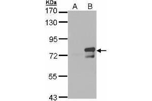 Image no. 1 for anti-Strawberry Notch Homolog 1 (SBNO1) (Center) antibody (ABIN2856024)