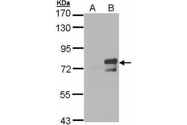 SBNO1 antibody  (Center)